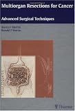 Multiorgan Resections for Cancer: Advanced Surgical Techniques