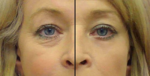Eye Secrets Under Eye Tightener Serum - Reduces Fine Lines, Wrinkles and Puffy Eyes