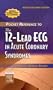 Pocket Reference to The 12-Lead ECG in Acute Coronary Syndromes - Revised Reprint, 2e