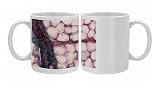 Blood vessel Photo Mugs
