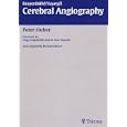 Cerebral Angiography by Peter Huber