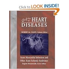 Atlas of Heart Diseases, Acute Myocardial Infarction and Other Acute Ischemic Syndromes,... by Eugene Braunwald and Robert M. Califf