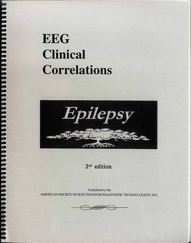 Epilepsy