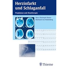 Herzinfarkt und Schlaganfall Manual