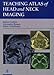 Teaching Atlas of Head and Neck Imaging