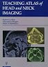 Teaching Atlas of Head and Neck Imaging