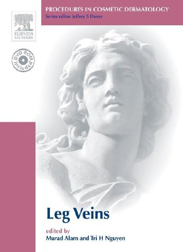 procedures in cosmetic dermatology series treatment of leg veins text with dvd 1e