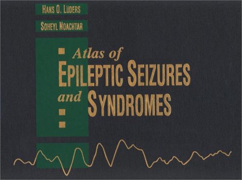 Epilepsy