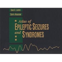 Atlas of Epileptic Seizures and Syndromes