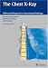 Search : The Chest X-Ray: Differential Diagnosis in Conventional Radiology