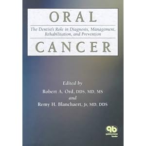 Click here to buy Oral Cancer: The Dentist's Role in Diagnosis, Management, Rehabilitation, and... by Robert A. Ord and Remy H. Blanchaert.