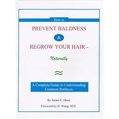 How to Prevent Baldness & Regrow Your Hair-Naturally