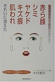 赤ら顔、シミ、ヤケド、キズ痕、肌われきれいに消えた―マグネテラピーで素肌がよみがえる!
