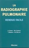 La radiographie pulmonaire rendue facile