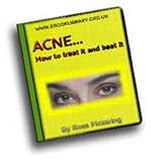419benKWuUL. SL160  Acne   How to Treat It and Beat It