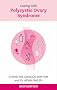Coping with Polycystic Ovary Syndrome