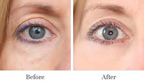 AMAZING FOR PUFFY EYES, DARK CIRCLE TREATMENT DERMISA ENHANCE APPEARANCE