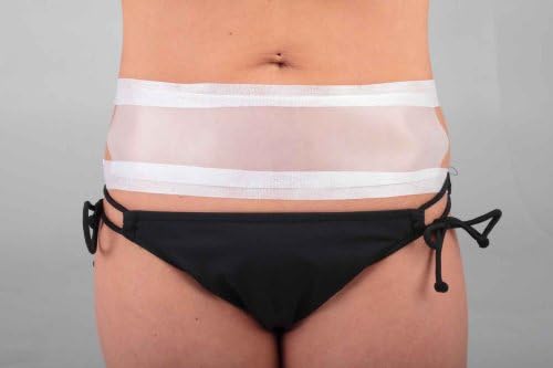 Scar Management Silicone Sheet 10 cm x 20 cm (4"x 8") - Guranteed Scar Treatment. Includes 1 Washable and Reusable Silicone Sheet Plus 4' of Rejuveness Tape. Effective for 6 Months of Treatment - Results in 1 - 2 weeks - Average Healing Time 1 - 3 Months.