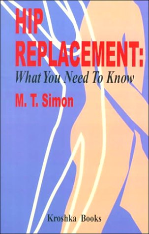Hip Replacement: What You Need to Know