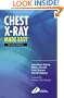Chest X-Ray Made Easy, 2e