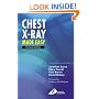 Chest X-Ray Made Easy