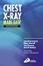 Chest X-Ray Made Easy by Jonathan Corne ISBN 0443070083