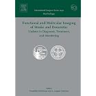 Functional and Molecular Imaging of Stroke and Dementia: Updates in Diagnosis, Treatment ,... by Tsunehiko Nishimura and A. Gregory Sorensen