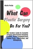  ... , Breast Augmentation, Tummy Tucks, Liposuction, and Rhinoplasty