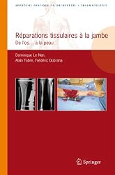 Réparations tissulaires à la jambe: De l'os...à la peau (Approche pratique en orthopédie-traumatologie) (French Edition)