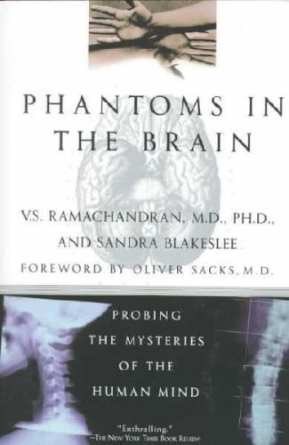 Phantoms in the Brain