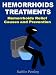 Hemorrhoids Treatments Hemorrhoids Relief Causes And Prevention