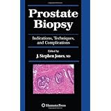 Prostate Biopsy: Indications, Techniques, and Complications