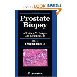 Click here to buy Prostate Biopsy: Indications, Techniques, and Complications (Current Clinical... by J. Stephen Jones.