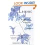 Lupus: Alternative Therapies That Work