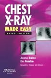 Chest X-Ray Made Easy (Made Easy Series)