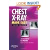 Chest X-Ray Made Easy, 3e