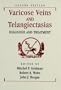 Varicose Veins and Telangiectasias: Diagnosis and Treatment