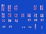 Normal Male Karyotype Paired Chromosomes Photographic Poster Print, 32x24