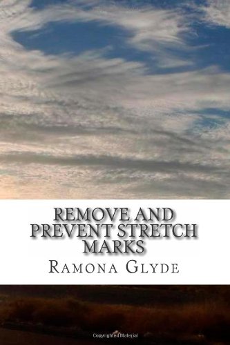 how to get rid of stretch marks