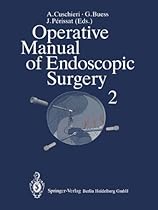 Operative Manual of Endoscopic Surgery 2 (v. 2)
