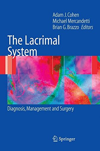 The Lacrimal System: Diagnosis, Management and Surgery