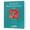 Advanced Reconstruction: Knee