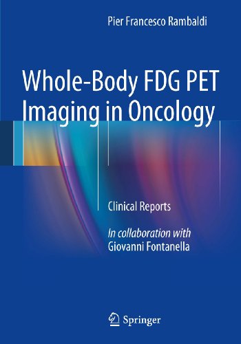 Whole-Body FDG PET Imaging in Oncology: Clinical Reports