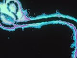 Ebola Virus Micrograph Enhansed Photographic Poster Print, 24x18