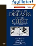 Imaging of Diseases of the Chest: Exp...
