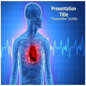 Office Powerpoint Themes on Amazon Com  Heart Attack Powerpoint Template   Powerpoint Templates On