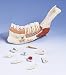 3B Scientific Half Lower Jaw 8 Diseased Teeth Mode