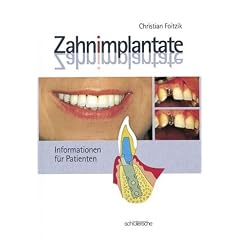 Zahnimplantate