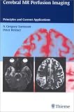 Cerebral MR Perfusion Imaging: Book + CD-ROM Set: Principles and Current Applications