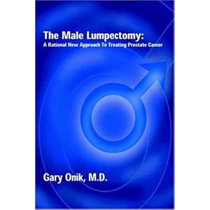 Male Lumpectomy Therapy Prostate Cancer 2